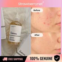 Nước hoa hồng tẩy tế bào chết Glycolic Acid 7% The Ordinary - Cải thiện độ trong và kết cấu của da 240ml/8oz - Màu Mù tạt vàng - Xem 1