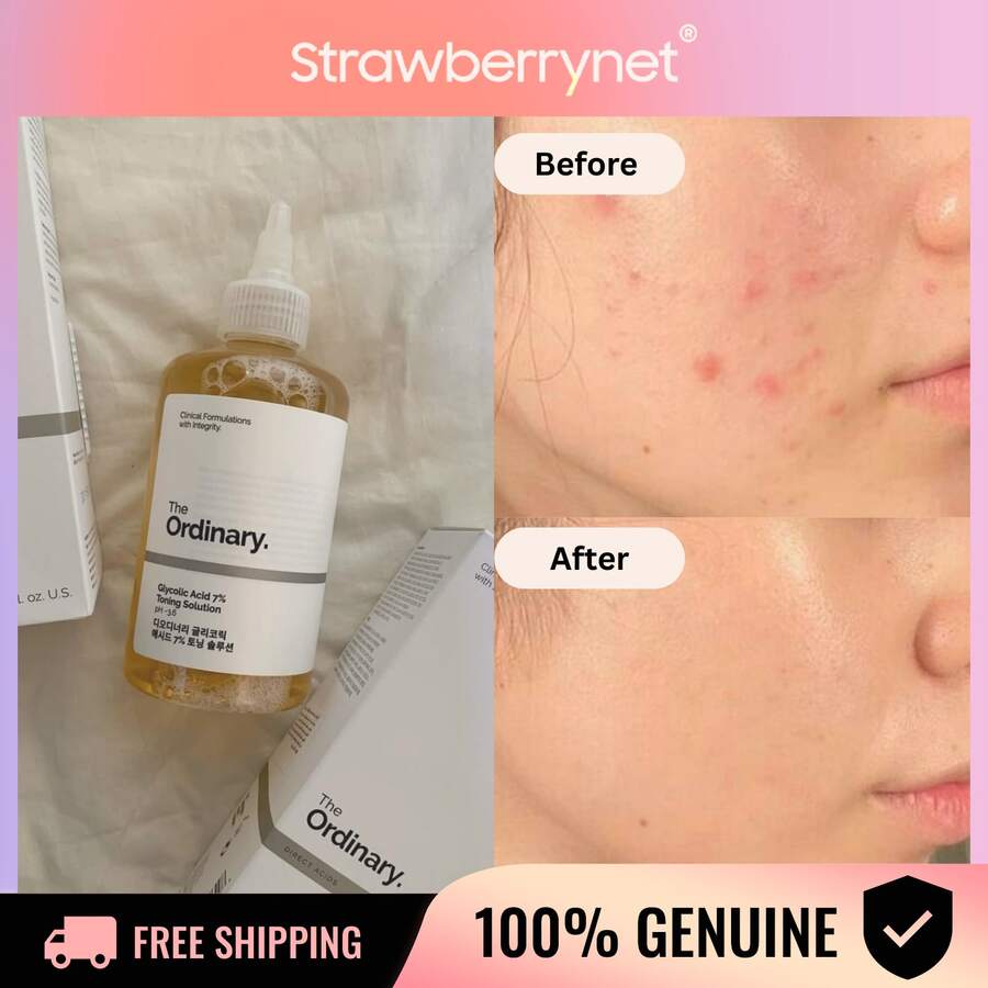 Nước hoa hồng tẩy tế bào chết Glycolic Acid 7% The Ordinary - Cải thiện độ trong và kết cấu của da 240ml/8oz - Màu Mù tạt vàng - Xem 1