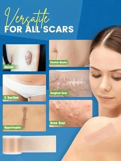 隐形疤痕贴，自粘硅胶疤痕贴，硅胶疤痕遮盖贴，隐形硅胶疤痕贴，用于遮盖身体瑕疵和疤痕，便携易用的硅胶疤痕贴，可遮盖手术疤痕、增生性疤痕