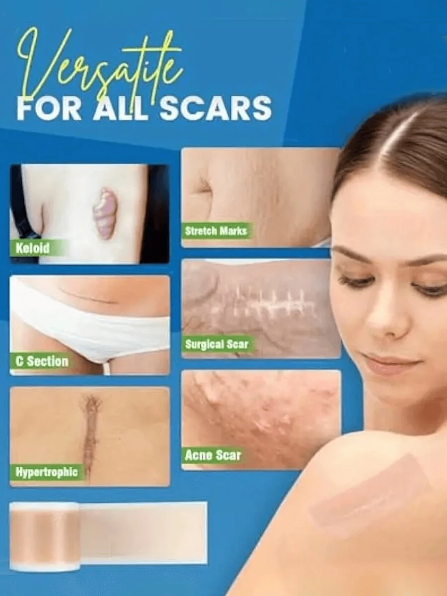 隐形疤痕贴，自粘硅胶疤痕贴，硅胶疤痕遮盖贴，隐形硅胶疤痕贴，用于遮盖身体瑕疵和疤痕，便携易用的硅胶疤痕贴，可遮盖手术疤痕、增生性疤痕 - 彩色 - 查看 1