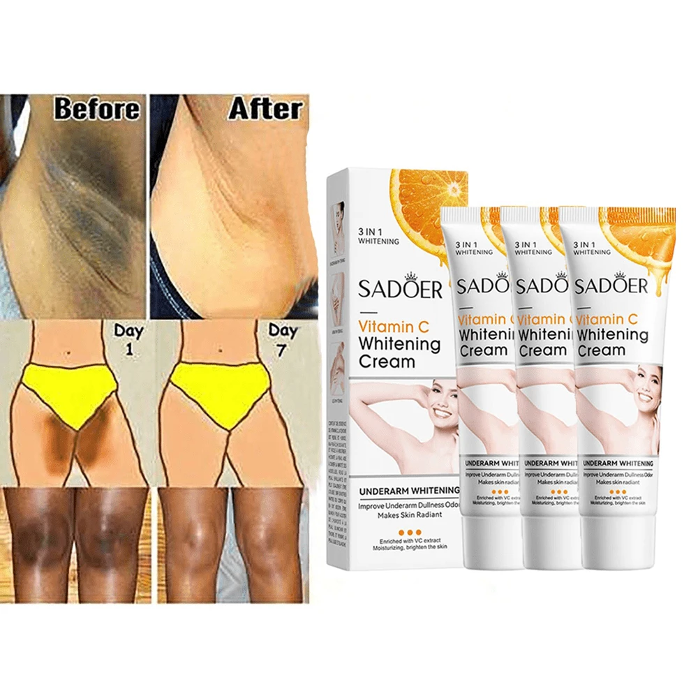 3 Pcs Skin Lightening Cream For Intimate Areas – Vitamin C Dark Spot Remover For Underarms, Knees, Elbows & Bikini Line Vitamin C Face Cream - Skin Brightening And Moisturizing Cream, Anti-Aging, Moisturizing, Skin Wrinkle Cream - Vitamin B5, Vitamin E, Jojoba Oil - 彩色 - 查看 1