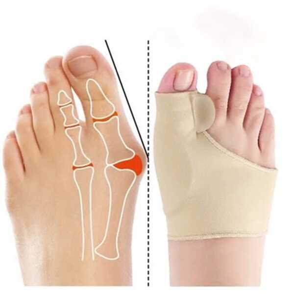 2 buc. tampoane cu gel: instrumente pentru îngrijirea picioarelor pentru uz nocturn și acasă - potrivite pentru bărbați și femei - se spală doar manual - potrivite pentru alergători - ușor de purtat - fabricate din lycra (spandex)
