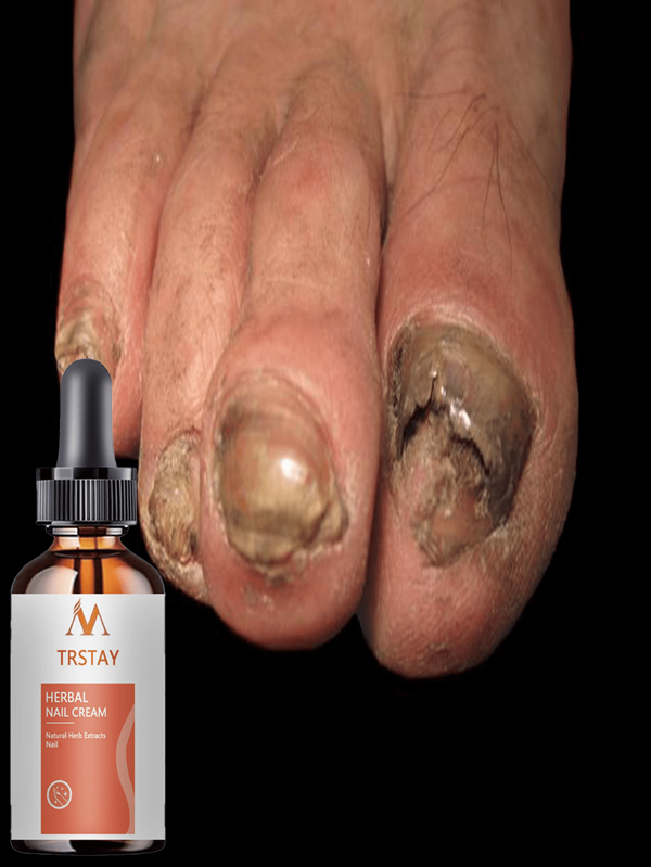 Professional Nail Care Essence Locks Water And Moisturizes To Save Fragile Nails