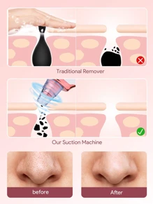 Extractor de puntos negros con succión - Masajeador facial de belleza recargable por USB, kit de limpiador de poros multifuncional, herramienta extractora de limpieza para adultos