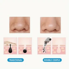 Upgraded Blackhead Remover Tool, 3 Adjustable Suction Levels, 5 Replacement Heads, USB Rechargeable Facial Pore Cleaner, Unisex - White - View 9