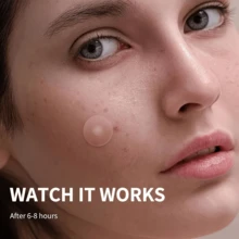 720片星形水胶体祛痘贴，透明贴片，易撕线设计，遮瑕贴，温和护肤 - 彩色 - 查看 7