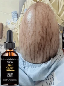 Fading Lines, Moisturizing Oil, Softening And Moisturizing The Dry And Cracked Abdominal Muscles, Repairing Stretch Marks, Rough Texture, And Rough Touch - 彩色 - 查看 3