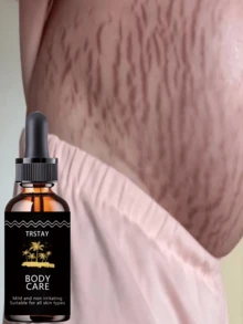Fading Lines, Moisturizing Oil, Softening And Moisturizing The Dry And Cracked Abdominal Muscles, Repairing Stretch Marks, Rough Texture, And Rough Touch - 彩色 - 查看 2