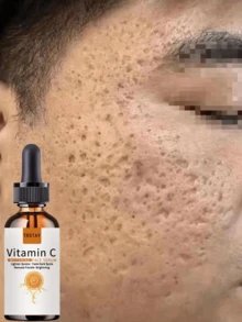 Pores Are Flexible, And The Essential Oil For Reducing Wrinkles And Enhancing The Elasticity And Tightness Of The Jawline Can Lighten Puppet Lines And Grooves - Nhiều màu - Xem 3