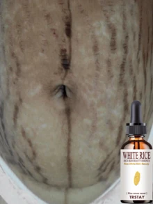 Moisturizing And Lightening Stretch Marks, Deep Moisturizing And Drying The Skin, Reducing Rough Texture On The Waist And Abdomen - 彩色 - 查看 2