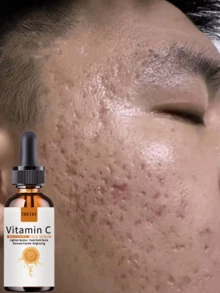 Pores Are Flexible, And The Essential Oil For Reducing Wrinkles And Enhancing The Elasticity And Tightness Of The Jawline Can Lighten Puppet Lines And Grooves - Nhiều màu - Xem 2