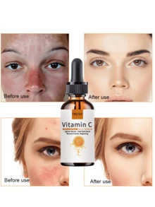 Pores Are Flexible, And The Essential Oil For Reducing Wrinkles And Enhancing The Elasticity And Tightness Of The Jawline Can Lighten Puppet Lines And Grooves - Nhiều màu - Xem 4