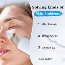 Ultrasonic Facial Cleansing Device - USB Rechargeable, Vibrating Face Blackhead Remover, Scraping Exfoliating Beauty Tool, Cost-Effective Skincare Device, Includes 2 Silicone Heads, 4 Modes, Perfect Tool For Blackhead Removal - Multicolor - View 7