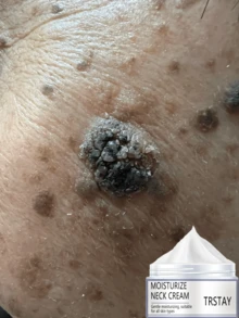 Powerful Moisturizing And Anti Wrinkle Body Lotion Reduces Body Wrinkles, Making The Skin Smooth And Elastic - Multicolor - View 3