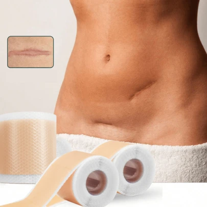 1 片自粘硅胶疤痕贴 - 4 厘米疤痕凝胶胶带卷、硅胶疤痕胶带、超级纹身遮盖贴、防水防汗疤痕遮盖胶带、可修剪隐形疤痕和胎记贴纸