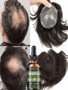 Fragile Hair Texture, Anti Shedding Essential Oil, Strong Hair Roots, Reduced Abnormal Hair Loss, Visually Creating A Fluffy And Dense Effect - Multicolor - View 2