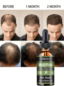 Fragile Hair Texture, Anti Shedding Essential Oil, Strong Hair Roots, Reduced Abnormal Hair Loss, Visually Creating A Fluffy And Dense Effect - Multicolor - View 5
