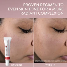 2pcs Dark Spot Corrector, Dark Spot Remover For Face - For Stubborn Dark Spots Serum, Dark Spot Remover With Kojic Acid, Alpha Arbutin, Mulberry Extract, Brightening Discoloration Correcting Serum - 彩色 - 查看 5