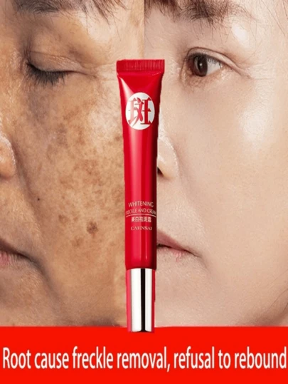Creme forte original para remover manchas escuras/clareamento pigmentado/cuidados com a pele QRJZ DV4D