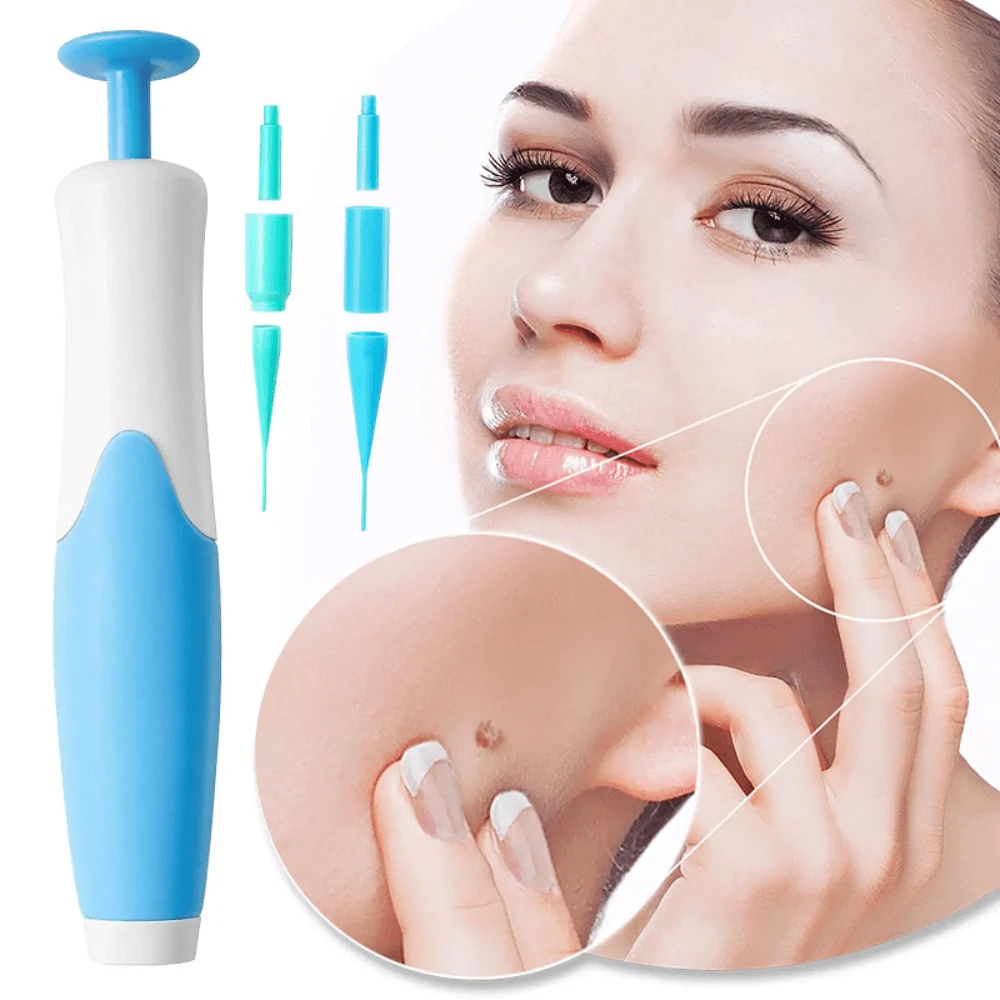 2-In-1 Automatic Skin Tag Removal Kit, Painless Care For Most Body Parts (2-8mm), Home Care Tool Accessories - 藍色 - 查看 1