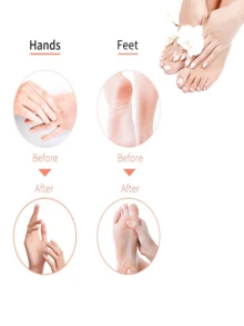 2~200 Disposable Hand And Foot Care Sets, Trial Shoe Covers, Socks, Suitable For Hand And Foot Care, Can Be Used Together With Essential Oil Lotion. - Multicolor - View 5