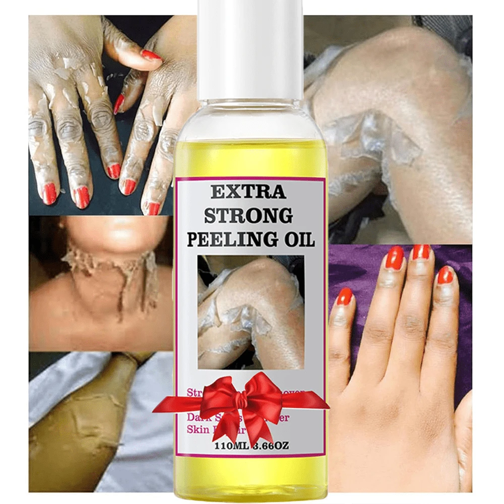 Chemical Peel For Face & Body, Extra Strong Peeling Oil For Dark Skin Remover, Gentle Exfoliator For Smooth & Radiant Skin | Removes Dead Skin & Impurities | Suitable For All Skin Types,Korean Skincare - 彩色 - 查看 1