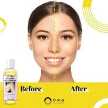 Peeling Oil For Dark Skin, Yellow Peeling Oil With Salicylic Sodium Hyaluronate, Strong Peeling Oil, Exfoliating Peeling Solution - 彩色 - 查看 3