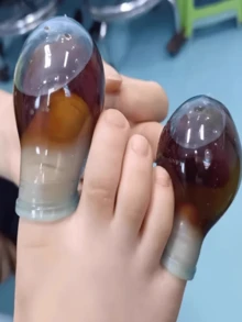 1/2 Waterproof Finger Injury Protection Covers, Suitable For Thumb, Toe, Nail Fungus Treatment, Bathing Finger Covers, Used For Wound Care And Skin Infections, Shower Toe Covers, Transparent Blue Silicone Toe Covers, Suitable For Sports And Daily Use