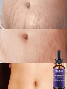 Whitening And Brightening Essential Oil Deeply Moisturizes Skin Fast Absorbing Non Sticky Formula Nourishes And Revitalizes Promotes Even Skin Tone For A Radiant Youthful Appearance - Multicolor - View 2