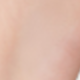 Hair Removal