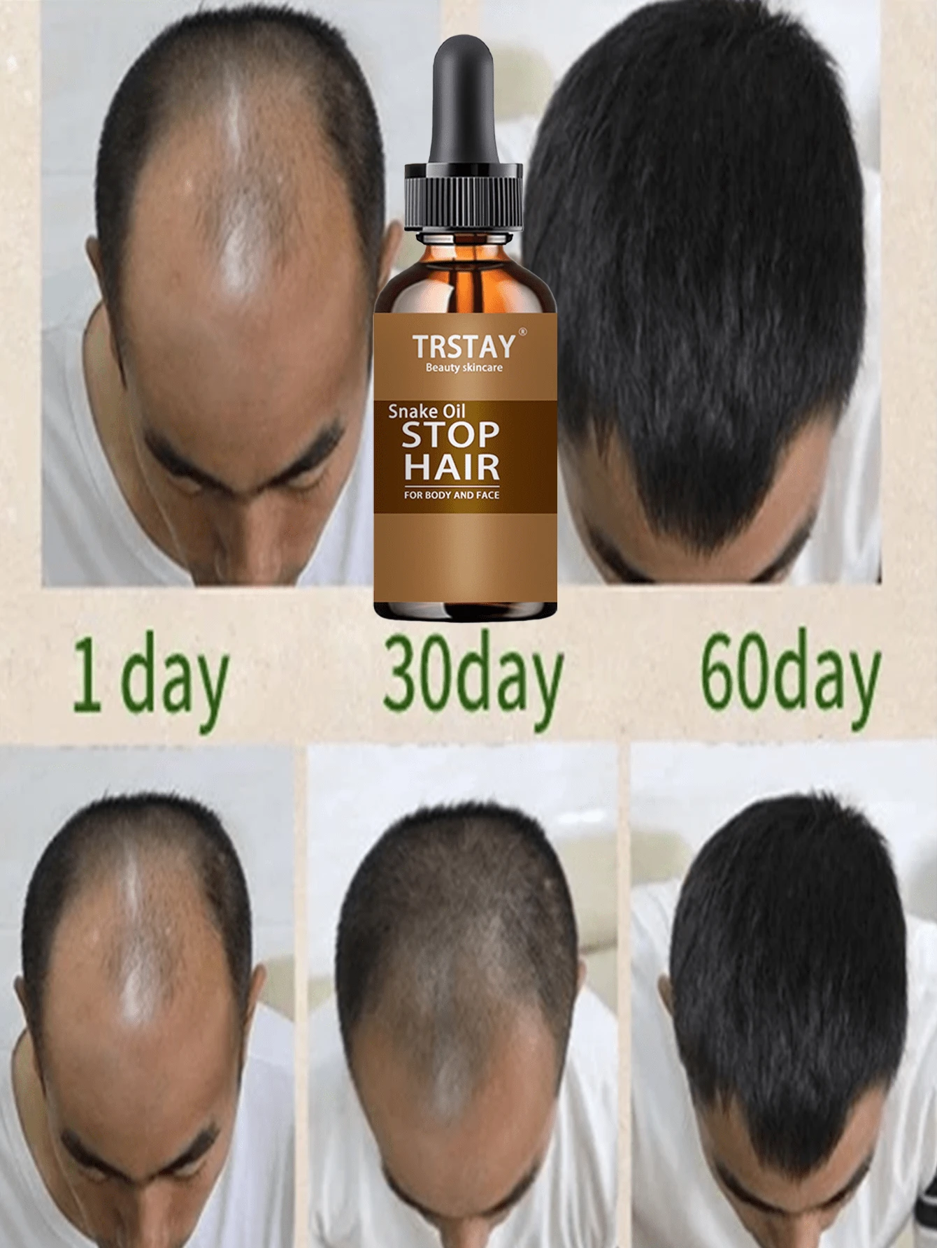 From Sparse To Dense Hair With Nourishing Essential Oils Activate Vitality Reduce Hair Loss And Create Voluminous Hair In One Step Perfect Hair Treatment For Daily Care - Multicolor - View 1