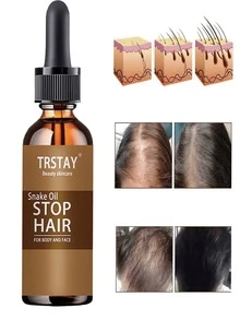 From Sparse To Dense Hair With Nourishing Essential Oils Activate Vitality Reduce Hair Loss And Create Voluminous Hair In One Step Perfect Hair Treatment For Daily Care - Multicolor - View 5