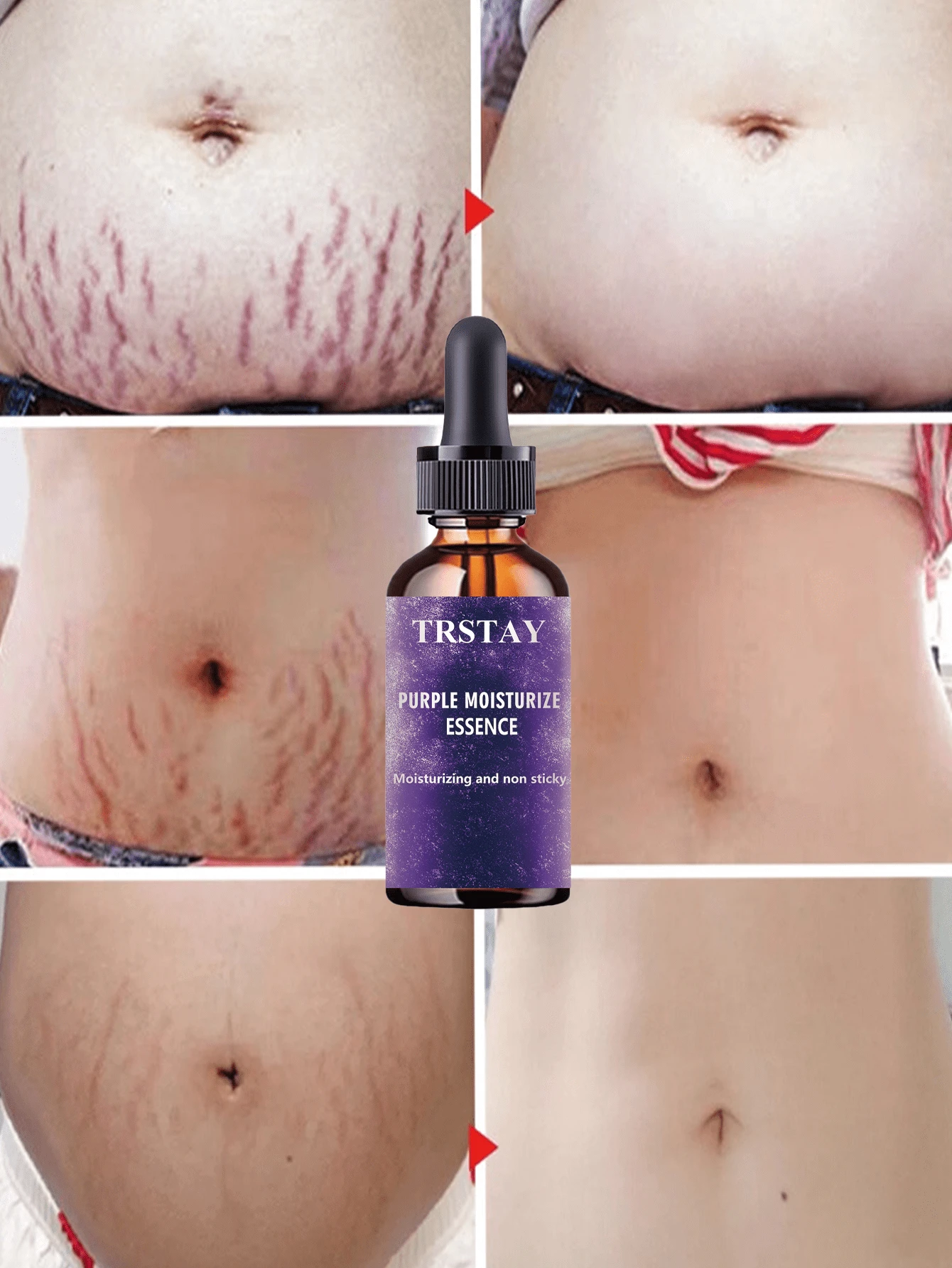 Whitening And Brightening Essential Oil Deeply Moisturizes Skin Fast Absorbing Non Sticky Formula Nourishes And Revitalizes Promotes Even Skin Tone For A Radiant Youthful Appearance - Multicolor - View 1