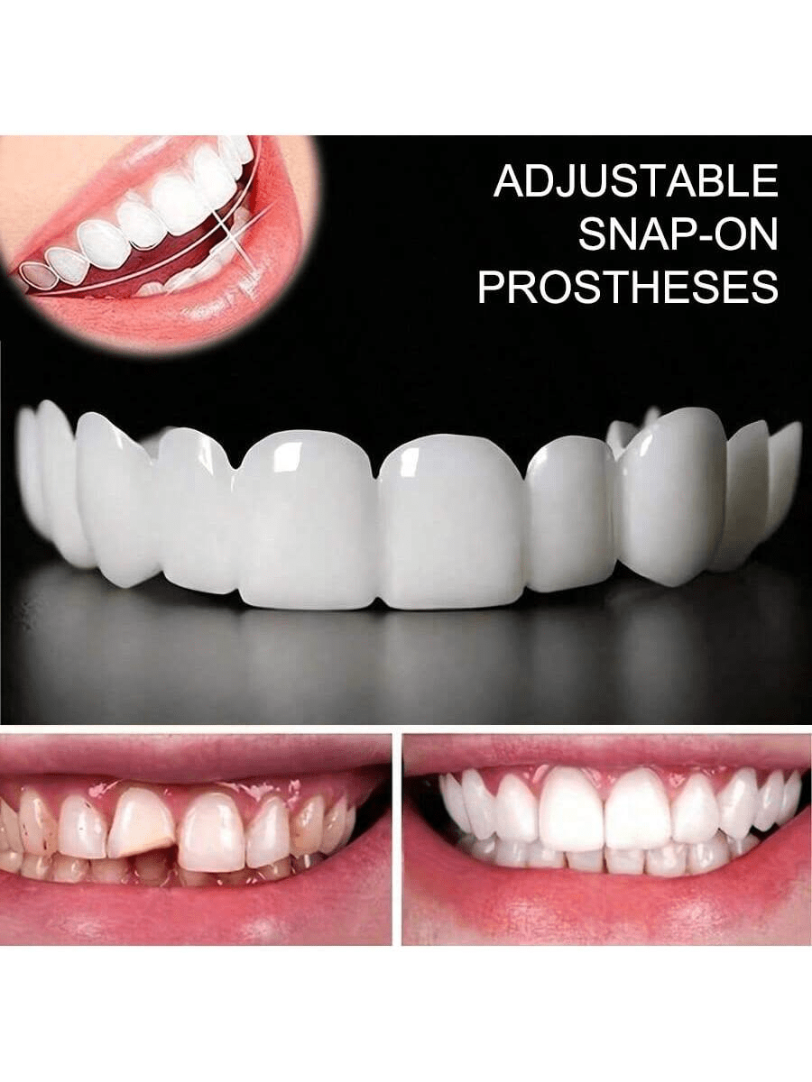Transform Your Smile With 1PC Comfortable & Snug Cosmetic Dentures: Upper & Lower Teeth For A Confident, Stunning Look