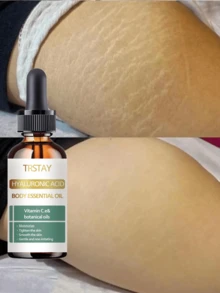 Whitening Essential Oil For Pregnant Lines Soft Elastic Moisturizing Essence Fades Dry Itchy Lines Gradually Revealing Delicate Smooth Skin - Multicolor - View 1