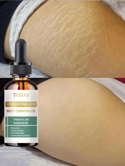 Whitening Essential Oil For Pregnant Lines Soft Elastic Moisturizing Essence Fades Dry Itchy Lines Gradually Revealing Delicate Smooth Skin