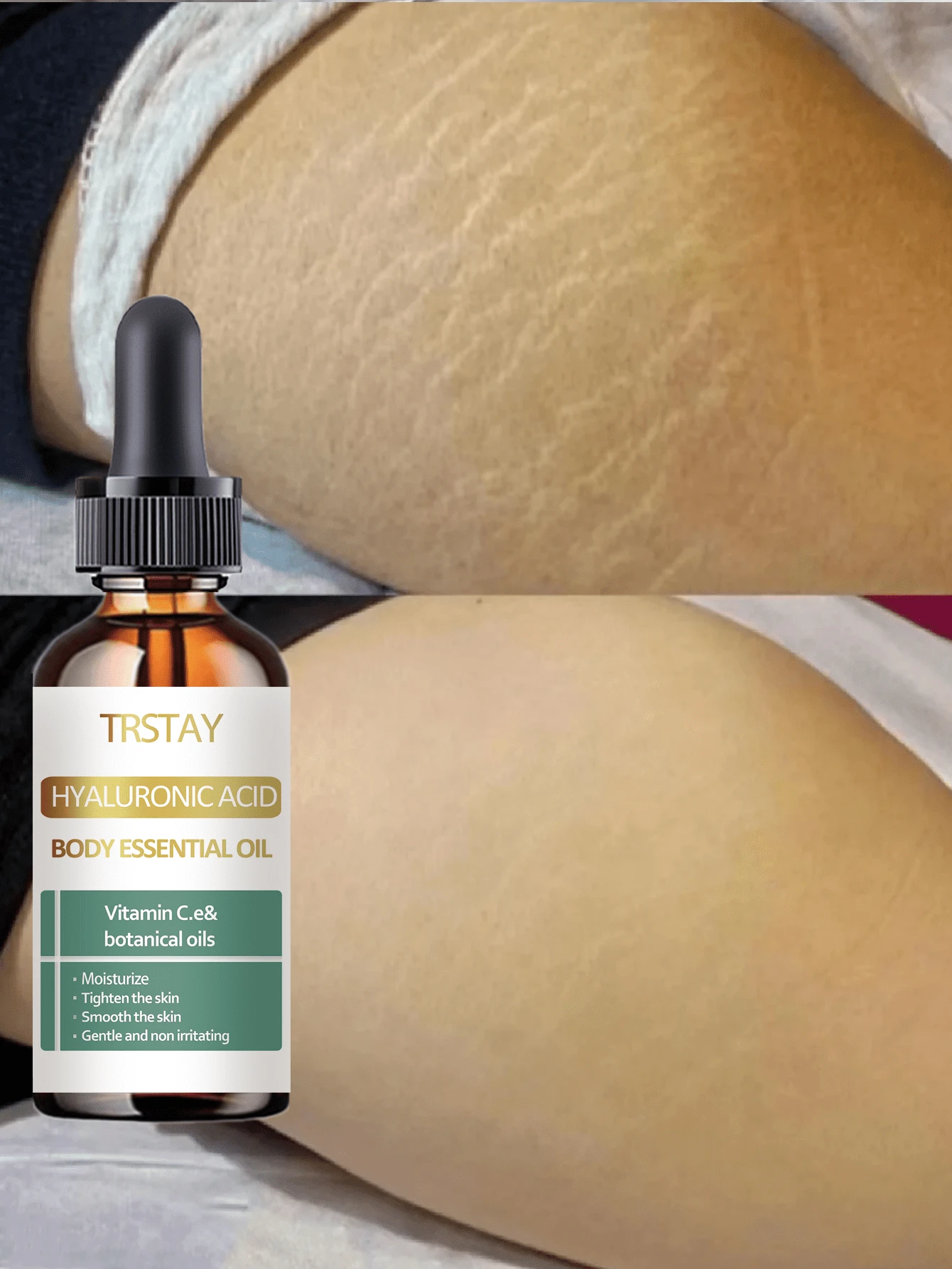 Whitening Essential Oil For Pregnant Lines Soft Elastic Moisturizing Essence Fades Dry Itchy Lines Gradually Revealing Delicate Smooth Skin - Multicolor - View 1
