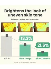 PAORPEVM 1/2/3 Bottles Of Spot Lightening And Brightening Serum, Brightening Serum Lightens Spots, Treats Pigmentation Dark Spots With 5% Rice Bran Repairs Brightness Firming And Moisturizing Face Serum For Uneven Skin Tone