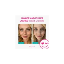 FLASH Eyelash Serum For Long, Curled Natural Lashes - Enhances &Amp; Strengthens, Safe &Amp; Effective Formula For Contact Wearers &Amp; Sensitive Eyes, 3 Month Supply - 2mL (007 Fl Oz) - 0.03 Fl Oz (Pack Of 1) - View 6