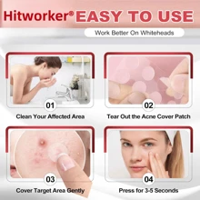 720 parches para acné y granos - Sin alcohol, sin parabenos, sin fragancias, parche limpiador de poros con adhesivo fuerte, apto para todos los tonos de piel clara, incluyendo piel sensible