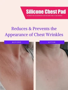 Silicone Patches Smoothes Skin Women Reusable Facial Patches For Chest Improves Skin Elasticity Facial Lifting Tools To Skin Looks Visibly Younger- Reduce Signs Of Aging For Women And Girls,Skin Care,Skin Care Tools,Lift,Wrinkle,Wrinkle Patches - Clear - View 5