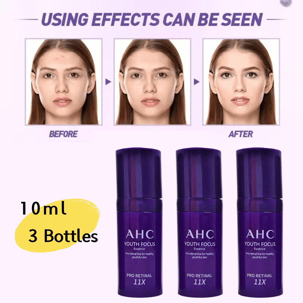  AHC Youth Focus Anti-Ageing Skin Essence Trial Pack All-In-One Anti-Ageing 10 Ml (3 Bottles)