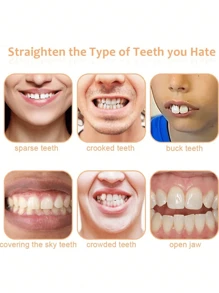 1 pieza Forro cómodo para dentaduras - Cuidado de belleza dental, protección de los dientes, recupera la confianza en tu sonrisa DIY