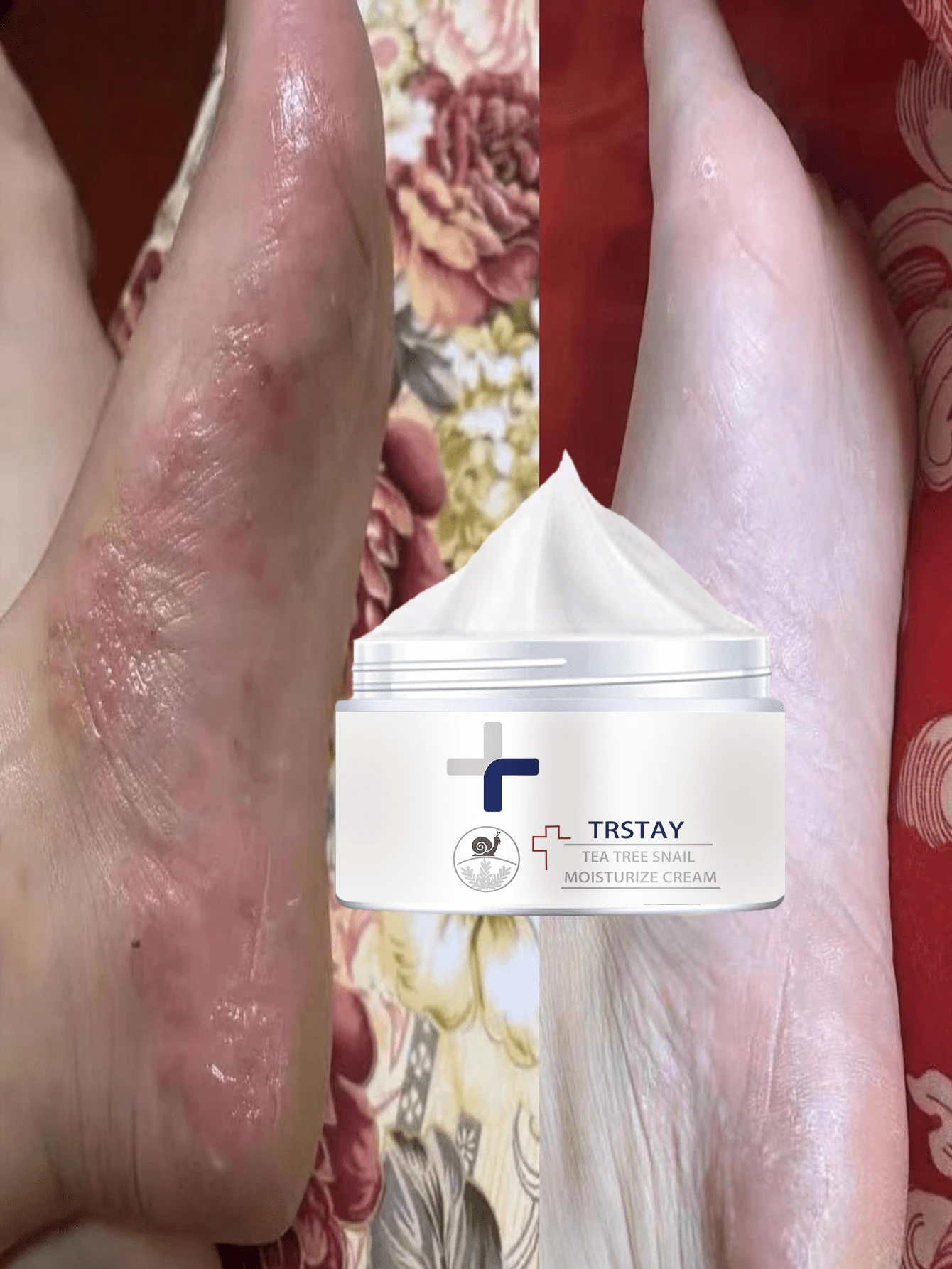 Repair And Moisturize Quickly Calm Dryness Itching And Discomfort Improve Redness And Dandruff In The Feet Refreshing And Non Sticky Foot Care For Soothing Relief - Multicolor - View 1
