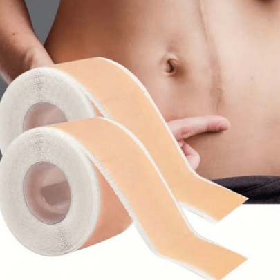 2 Rolos de Fita de Silicone Cobrindo Cicatrizes Hipoalergênica, 4cm de Largura, 15/50/100cm de Comprimento - Suave, Lavável e Reutilizável, Adequada para Cicatrizes Cirúrgicas, Cicatrizes de Cesariana e Queloides - Folhas de Silicone Macias, Respiráveis e à Prova d'Água, Ajuda a Gerenciar Efetivamente Cicatrizes, Fita para Cicatrizes, Cobertura de Tatuagem