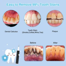 Plaque Remover For Teeth - Ultrasonic Tartar Remover Cleaning Kit For Teeth, Safe For Sensitive Gums Dental, Calculus Remover Teeth Cleaning Kit 4 Adjustable Cleaning With Replaceable Heads, IPX6 Waterproof With LED Light - Black - View 3