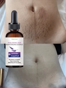 Essential Oil For Stretch Marks Prevention Deeply Moisturizes Skin Reduces Wrinkles Portable And Easy To Use Anytime Anywhere For Daily Skincare Routine - Multicolor - View 1
