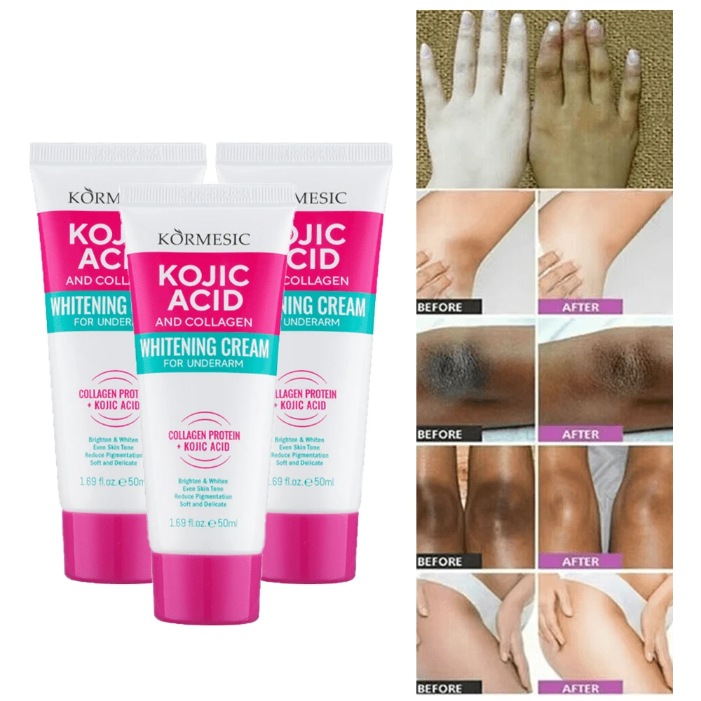 3 Pcs Skin Lightening Cream For Intimate Areas – Vitamin C Dark Spot Remover For Underarms, Knees, Elbows & Bikini Line Palmer's Skin Success Anti-Dark Spots Fade Milk Body Lotion - 彩色 - 查看 1