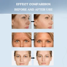 1pcs/4pcs/8pcs Overnight Hydrogel Mask,Deep Hydrating Masks With Collagen, Hyaluronic Acid,Hydrating Facial Mask For Sensitive Skin, Redness Reducing & Quick Soothing Effect - 藍色 - 查看 6