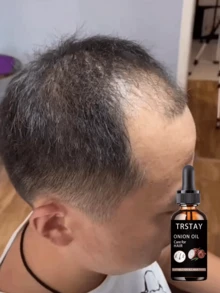 Repair Damaged Curly Hair Structure Lock In Moisture Without Loss Give Hair Flexibility And Elasticity Make Curls More Durable For Healthy Shiny Hair With Natural Bounce And Softness Perfect For Dry Frizzy Hair Types Deep Hydration Oil Control Cleansing Treatment For Curly Hair Restoration - 彩色 - 查看 3